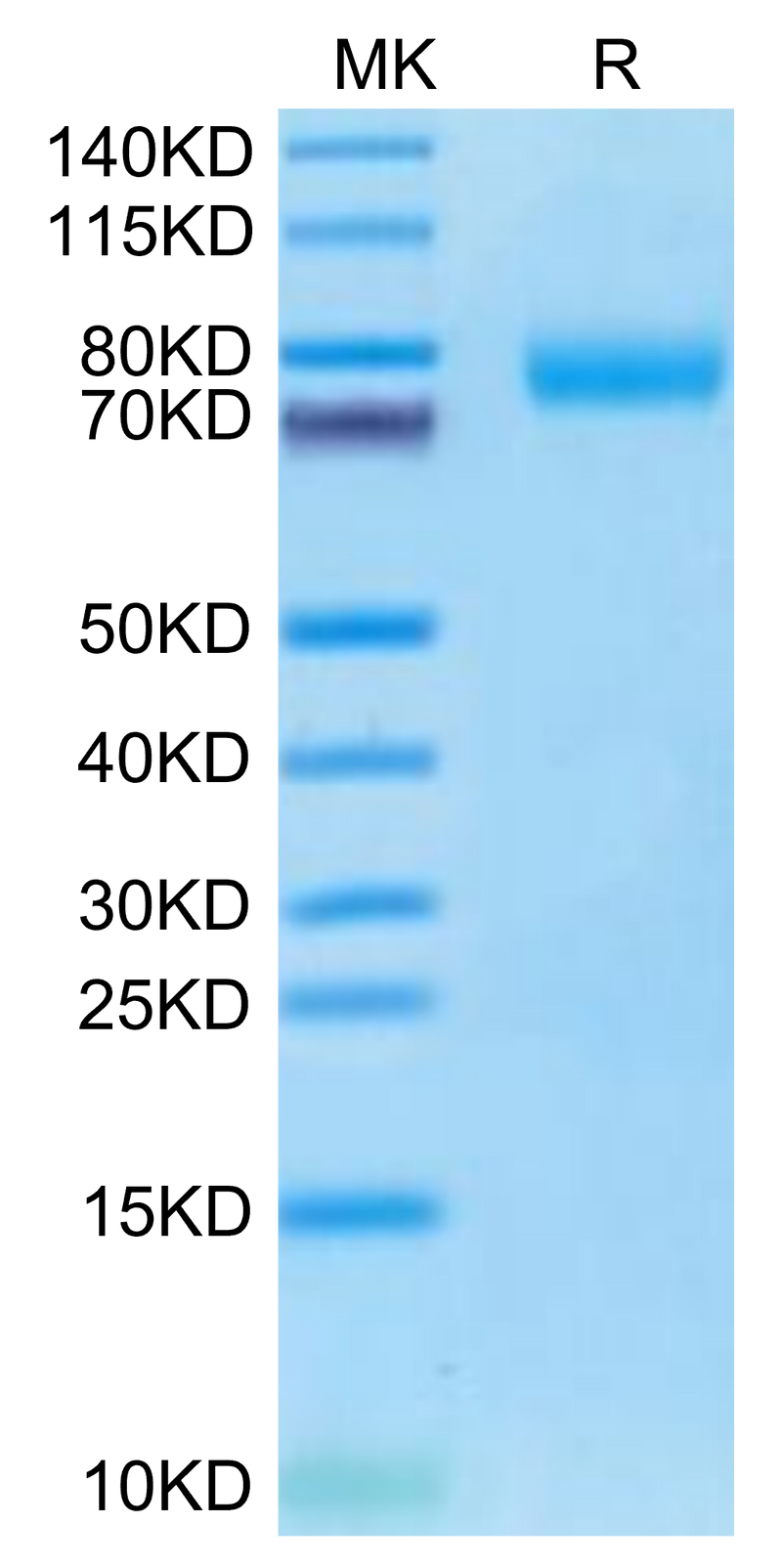 Cynomolgus BCAM on Tris-Bis PAGE under reduced condition. The purity is greater than 95%.Recombinant Cynomolgus BCAM Protein