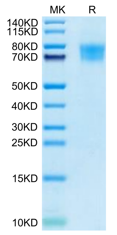 Cynomolgus TIM4 on Tris-Bis PAGE under reduced condition. The purity is greater than 95%.Recombinant Cynomolgus TIM4 Protein