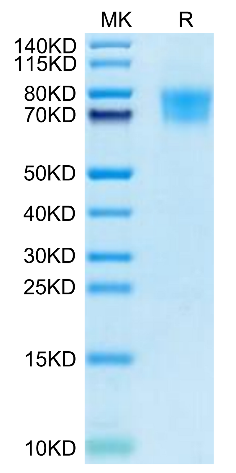 Cynomolgus TIM4 on Tris-Bis PAGE under reduced condition. The purity is greater than 95%.Recombinant Cynomolgus TIM4 Protein