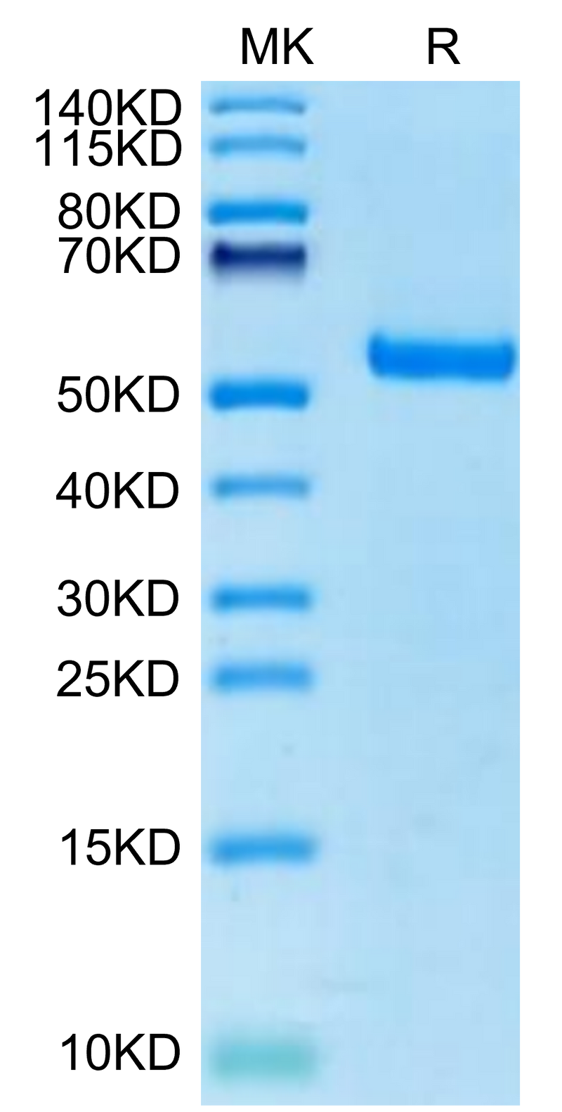 Canine EPHA3 on Tris-Bis PAGE under reduced condition. The purity is greater than 95%.Recombinant Canine EPHA3 Protein