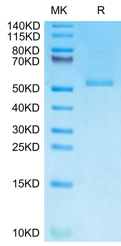 Monkeypox virus E8L on Tris-Bis PAGE under reduced condition. The purity is greater than 95%.Recombinant Monkeypox virus E8L Protein