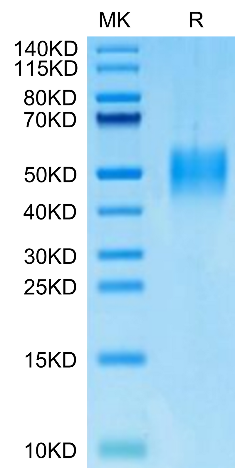 Mouse PILRA on Tris-Bis PAGE under reduced condition. The purity is greater than 95%.Recombinant Mouse PILRA Protein