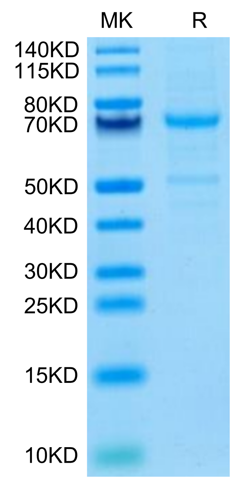 Mouse CDH3 on Tris-Bis PAGE under reduced condition. The purity is greater than 90%.Recombinant Mouse CDH3/Cadherin 3 Protein