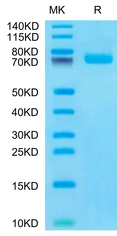 Human BCAM on Tris-Bis PAGE under reduced condition. The purity is greater than 95%.Recombinant Human BCAM Protein