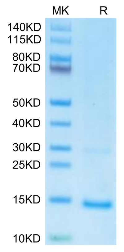 undefined on Tris-Bis PAGE under reduced condition. The purity is greater than 95%.Recombinant Monkeypox virus A29 Protein