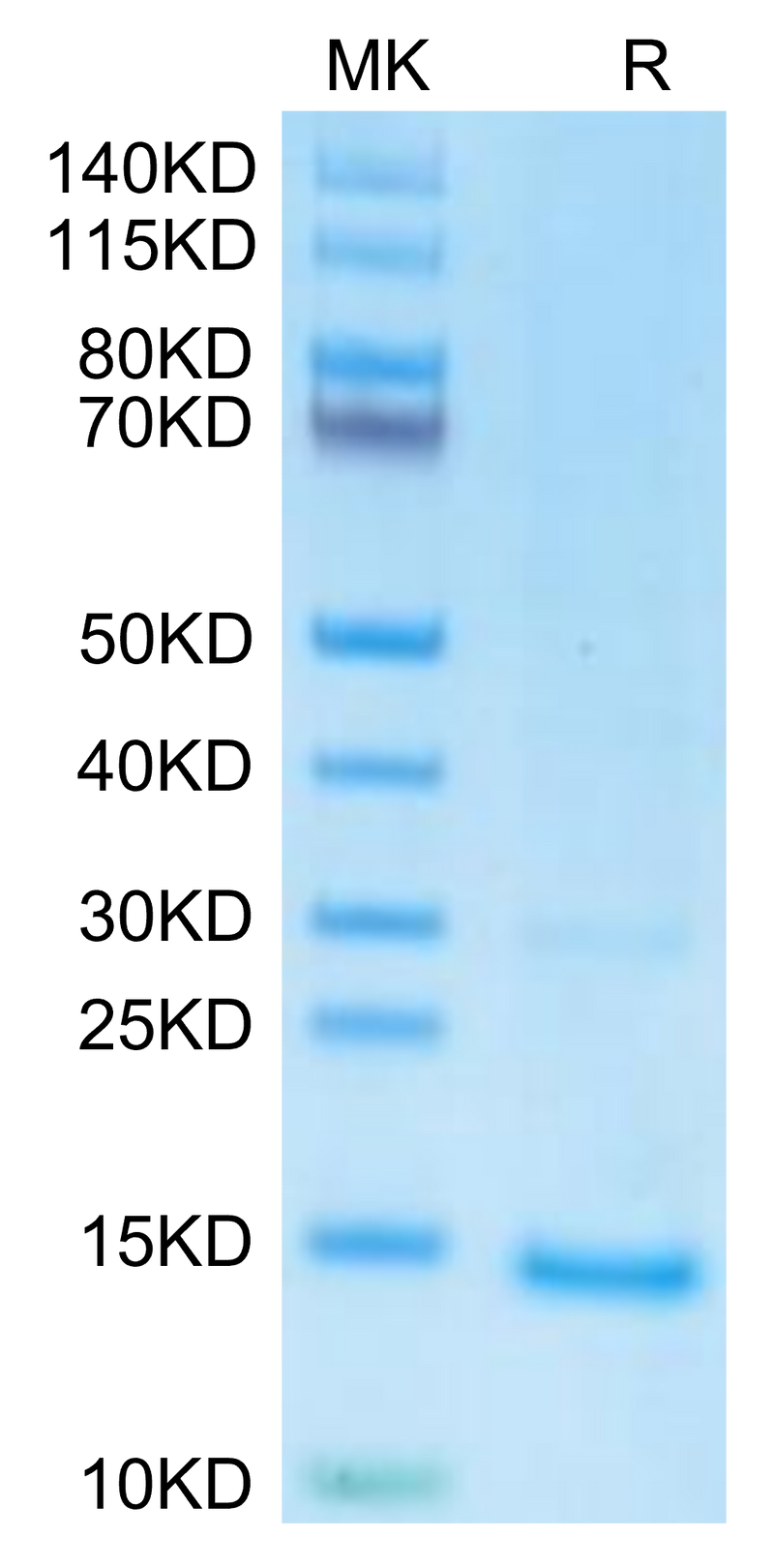 undefined on Tris-Bis PAGE under reduced condition. The purity is greater than 95%.Recombinant Monkeypox virus A29 Protein