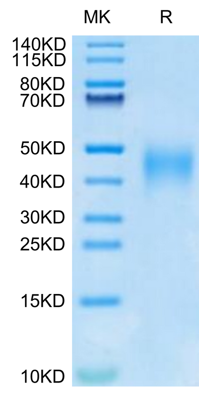 Human IL-9 on Tris-Bis PAGE under reduced condition. The purity is greater than 95%.Recombinant Human IL-9 Protein, Active