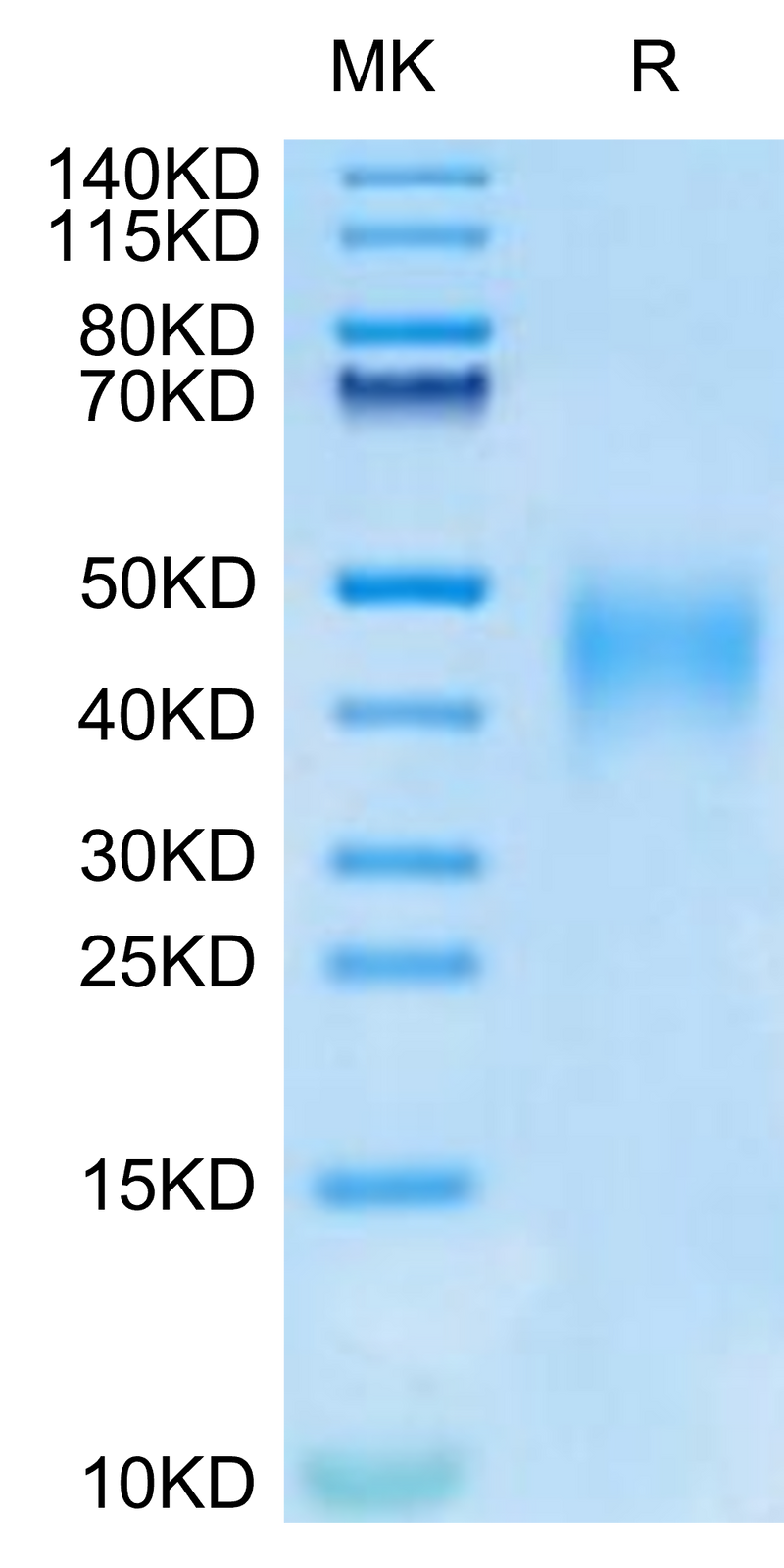 Human IL-9 on Tris-Bis PAGE under reduced condition. The purity is greater than 95%.Recombinant Human IL-9 Protein, Active