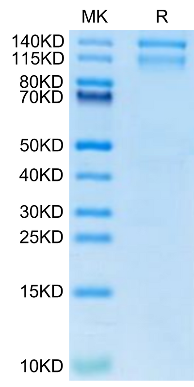 Mouse ITGA10&ITGB1 on Tris-Bis PAGE under reduced condition. The purity is greater than 95%.Recombinant Mouse Integrin alpha 10 beta 1 (ITGA10&ITGB1) Heterodimer Protein