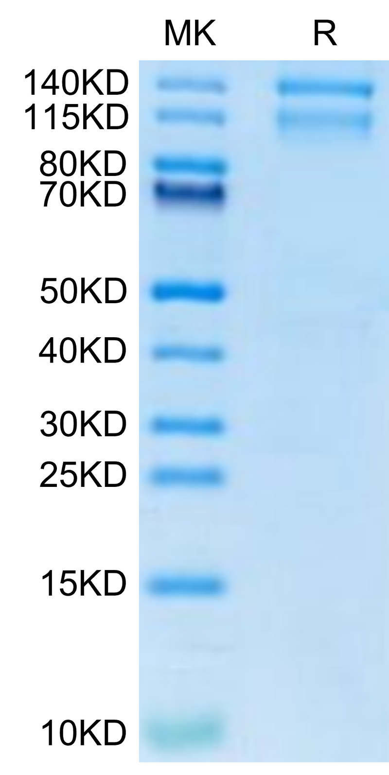 Mouse ITGA10&ITGB1 on Tris-Bis PAGE under reduced condition. The purity is greater than 95%.Recombinant Mouse Integrin alpha 10 beta 1 (ITGA10&ITGB1) Heterodimer Protein