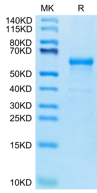 Human CDH17 Domain 6-7 on Tris-Bis PAGE under reduced condition. The purity is greater than 95%.Recombinant Human CDH17/Cadherin 17 Domain 6-7 Protein