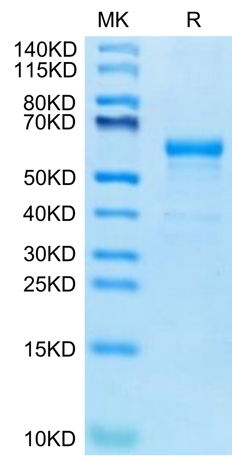 Human CDH17 Domain 6-7 on Tris-Bis PAGE under reduced condition. The purity is greater than 95%.Recombinant Human CDH17/Cadherin 17 Domain 6-7 Protein