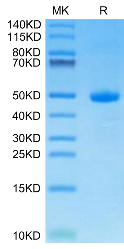 Human CDH17 Domain 7 on Tris-Bis PAGE under reduced condition. The purity is greater than 95%.Recombinant Human CDH17/Cadherin 17 Domain 7 Protein