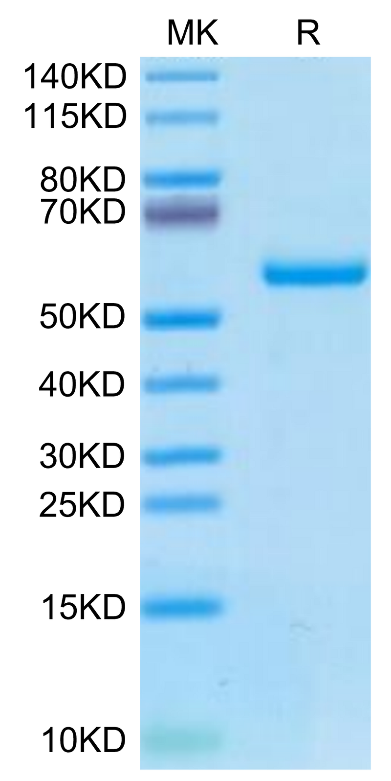 Biotinylated Human HLA-A*02:01&B2M&P53 R175H (HMTEVVRHC) Monomer on Tris-Bis PAGE under reduced condition. The purity is greater than 95%.Biotinylated Human HLA-A*02:01&B2M&P53 R175H (HMTEVVRHC) Monomer Protein, Active