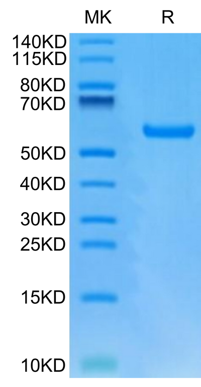 Human HLA-A*24:02&B2M&GP100 Intron 4 (VYFFLPDHL) Monomer on Tris-Bis PAGE under reduced condition. The purity is greater than 95%.Recombinant Human HLA-A*24:02&B2M&GP100 Intron 4 (VYFFLPDHL) Monomer Protein