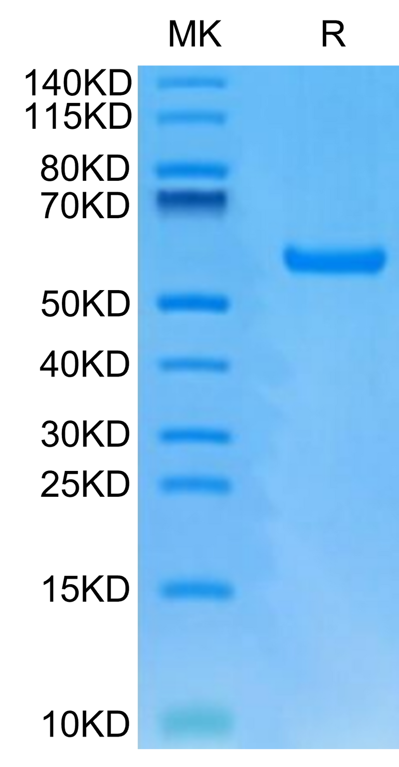 Human HLA-A*24:02&B2M&GP100 Intron 4 (VYFFLPDHL) Monomer on Tris-Bis PAGE under reduced condition. The purity is greater than 95%.Recombinant Human HLA-A*24:02&B2M&GP100 Intron 4 (VYFFLPDHL) Monomer Protein
