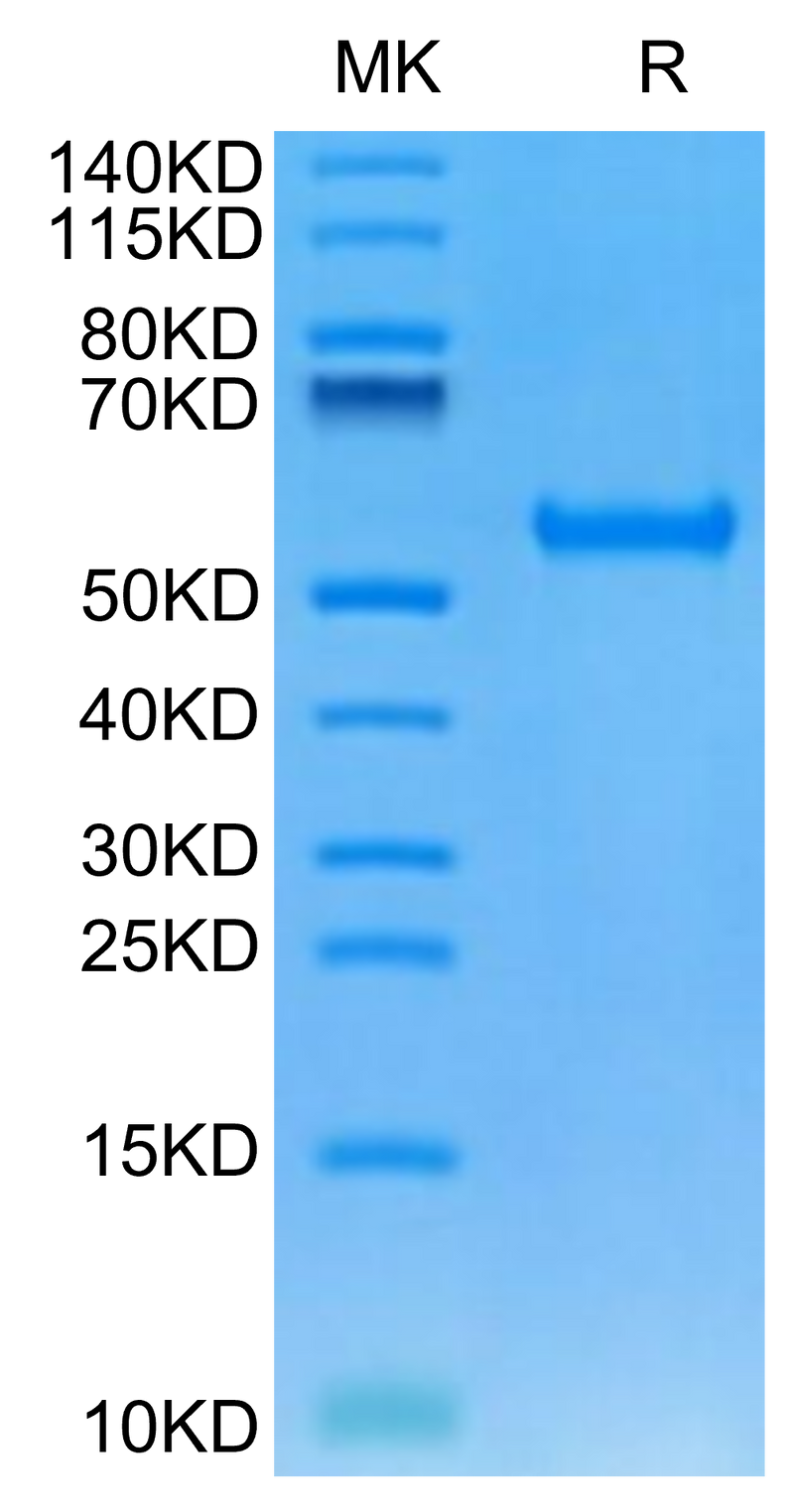 Human HLA-A*24:02&B2M&MAGE-A3 (IMPKAGLLI) Monomer on Tris-Bis PAGE under reduced condition. The purity is greater than 95%.Recombinant Human HLA-A*24:02&B2M&MAGE-A3 (IMPKAGLLI) Monomer Protein