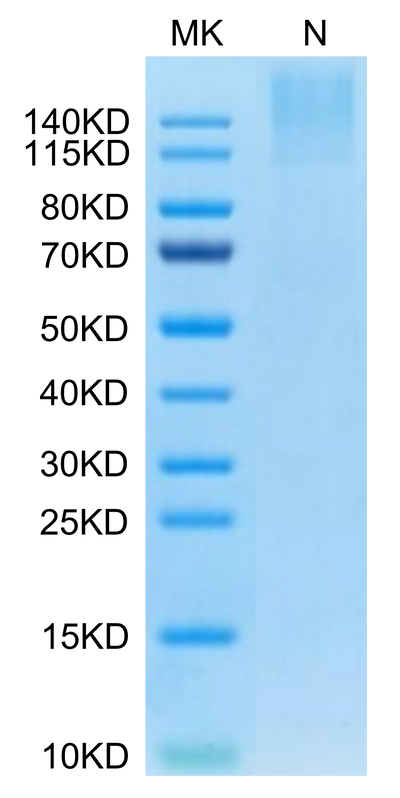 Human HLA-A*24:02&B2M&MAGE-A3 (IMPKAGLLI) Tetramer on Tris-Bis PAGE under Non reducing (N) condition. The purity is greater than 95%.Recombinant Human HLA-A*24:02&B2M&MAGE-A3 (IMPKAGLLI) Tetramer Protein