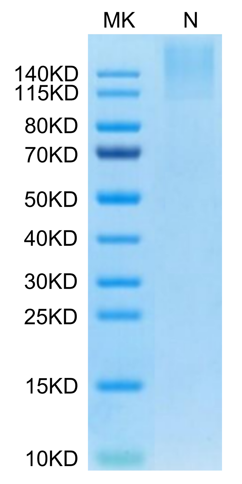Human HLA-A*24:02&B2M&MAGE-A3 (IMPKAGLLI) Tetramer on Tris-Bis PAGE under Non reducing (N) condition. The purity is greater than 95%.Recombinant Human HLA-A*24:02&B2M&MAGE-A3 (IMPKAGLLI) Tetramer Protein