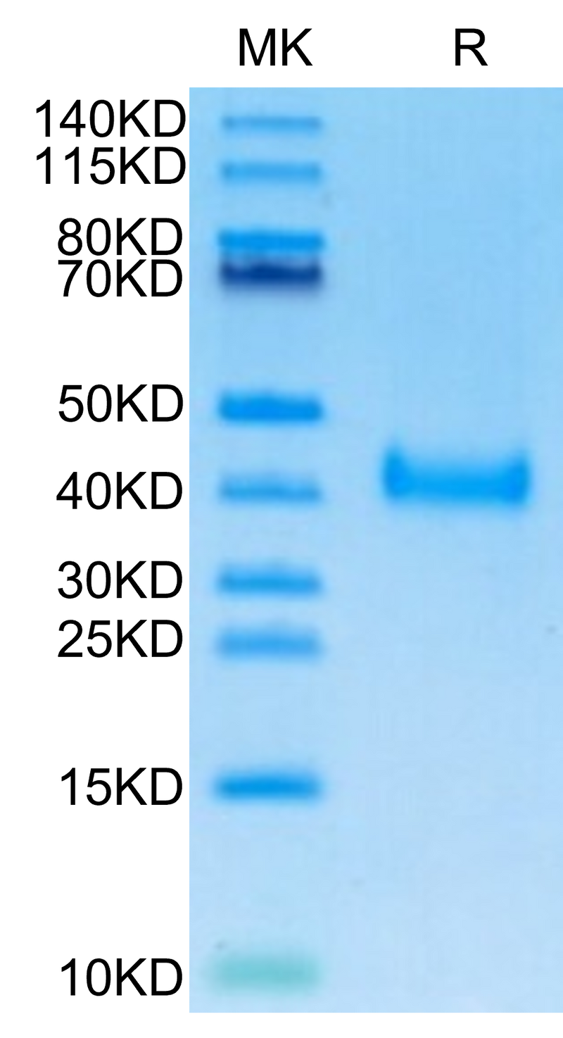 SARS-Cov-2 Spike RBD (Omicron BA.2.12.1) on Tris-Bis PAGE under reduced condition. The purity is greater than 95%.Recombinant SARS-Cov-2 Spike RBD (Omicron BA.2.12.1) Protein, Active
