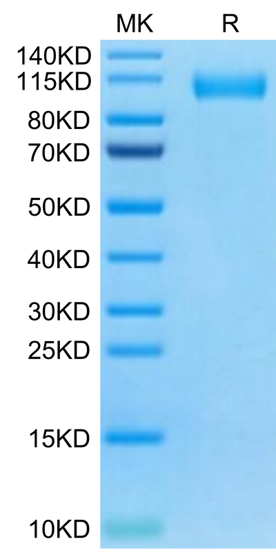 SARS-CoV-2 Spike S1 (Omicron BA.4/BA.5/BA.5.2) on Tris-Bis PAGE under reduced condition. The purity is greater than 95%.Recombinant SARS-CoV-2 Spike S1 (Omicron BA.4/BA.5/BA.5.2) Protein, Active