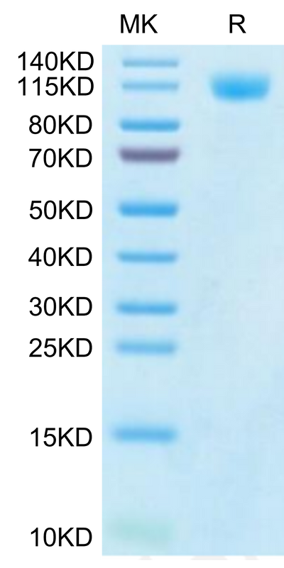 SARS-CoV-2 Spike S1 (Gamma P.1/P.1.1/P.1.2) on Tris-Bis PAGE under reduced condition. The purity is greater than 95%.Recombinant SARS-CoV-2 Spike S1 (Gamma P.1/P.1.1/P.1.2) Protein, Active