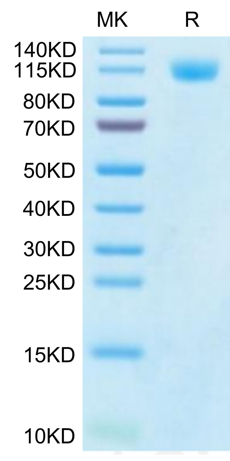 SARS-CoV-2 Spike S1 (Gamma P.1/P.1.1/P.1.2) on Tris-Bis PAGE under reduced condition. The purity is greater than 95%.Recombinant SARS-CoV-2 Spike S1 (Gamma P.1/P.1.1/P.1.2) Protein, Active
