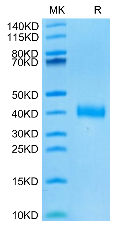 SARS-CoV-2 Spike RBD (Omicron BA.4/BA.5/BA.5.1.3/BA.5.2) on Tris-Bis PAGE under reduced condition. The purity is greater than 95%.Recombinant SARS-CoV-2 Spike RBD (Omicron BA.4/BA.5/BA.5.1.3/BA.5.2) Protein, Active