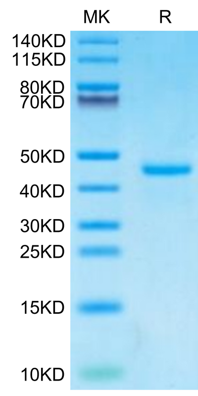 Human PTH on Tris-Bis PAGE under reduced condition. The purity is greater than 95%.Recombinant Human PTH Protein