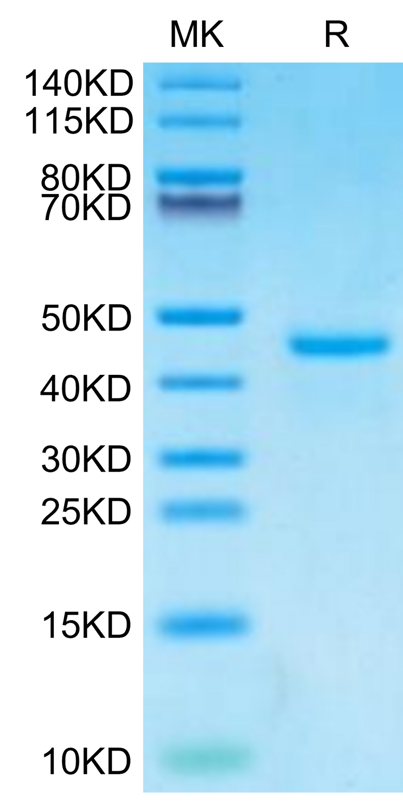 Human PTH on Tris-Bis PAGE under reduced condition. The purity is greater than 95%.Recombinant Human PTH Protein