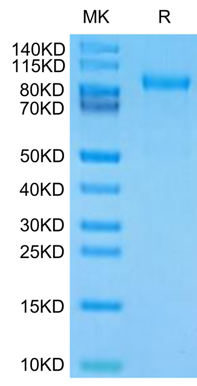 Human CDH17 Domain 1-6 on Tris-Bis PAGE under reduced condition. The purity is greater than 95%.Recombinant Human CDH17/Cadherin 17 Domain 1-6 Protein, Active