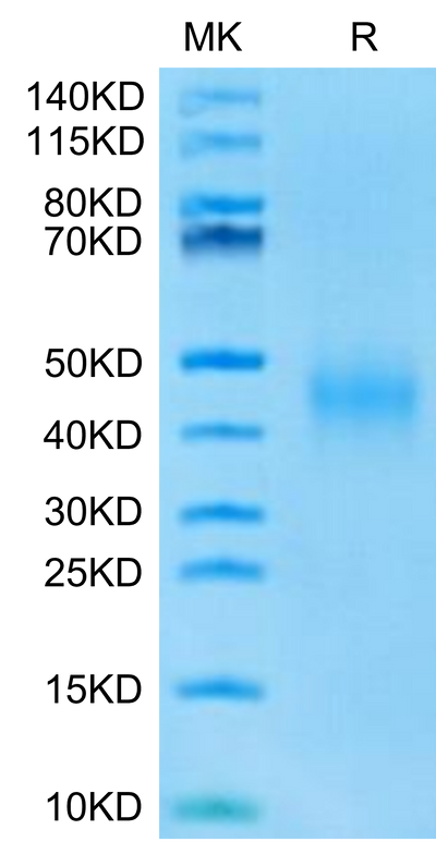 Mouse IL-9 on Tris-Bis PAGE under reduced condition. The purity is greater than 95%.Recombinant Mouse IL-9-Protein
