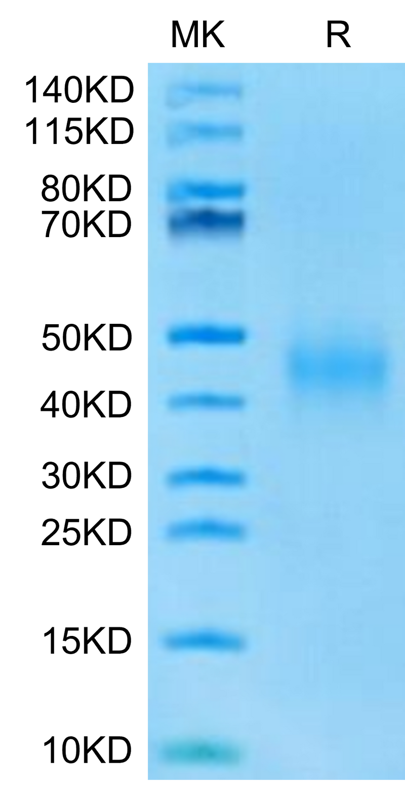 Mouse IL-9 on Tris-Bis PAGE under reduced condition. The purity is greater than 95%.Recombinant Mouse IL-9-Protein