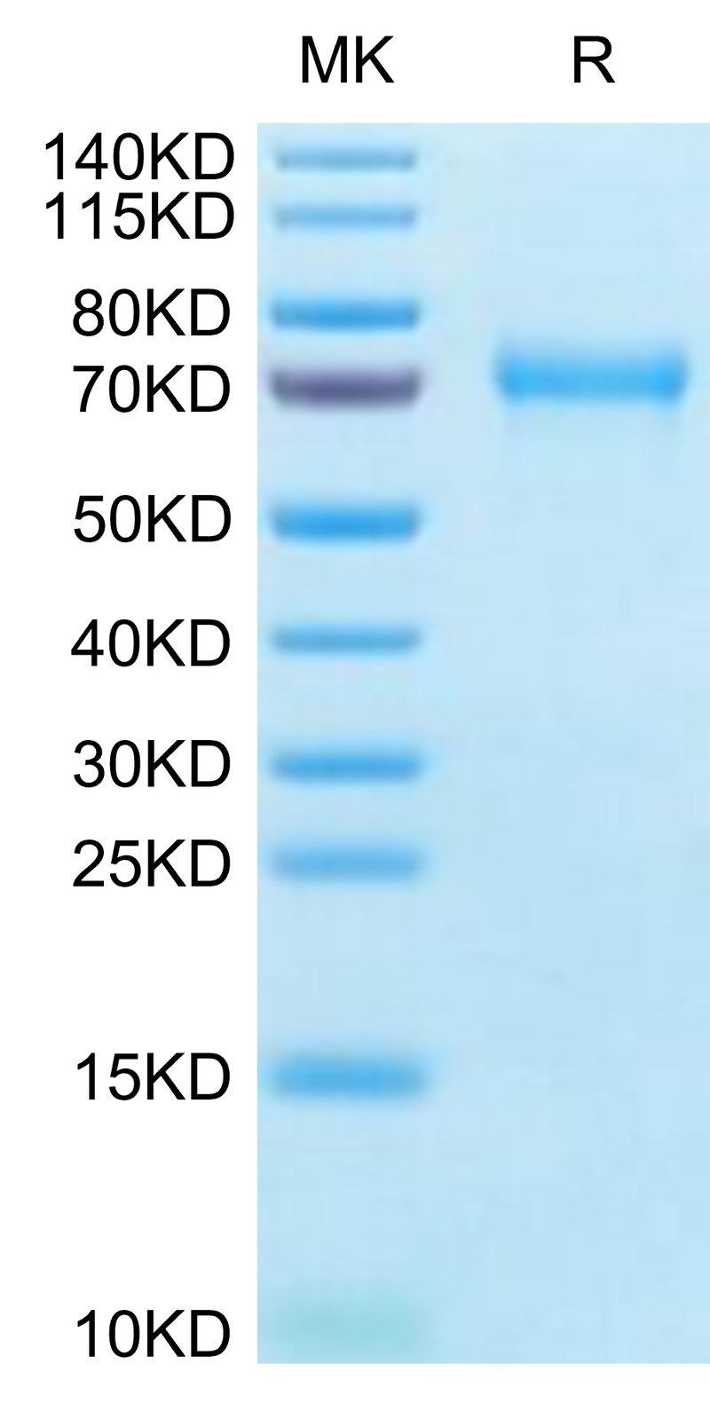 Mouse BCAM on Tris-Bis PAGE under reduced condition. The purity is greater than 95%.Recombinant Mouse BCAM Protein