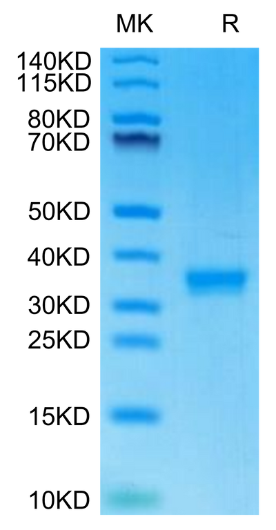 Mouse IgG2C on Tris-Bis PAGE under reduced condition. The purity is greater than 95%.Recombinant Mouse IgG2C Protein