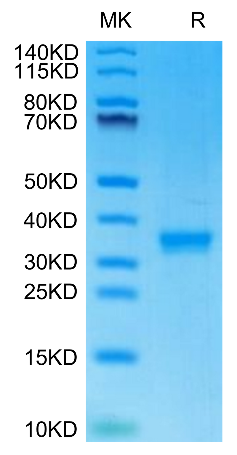 Mouse IgG2C on Tris-Bis PAGE under reduced condition. The purity is greater than 95%.Recombinant Mouse IgG2C Protein