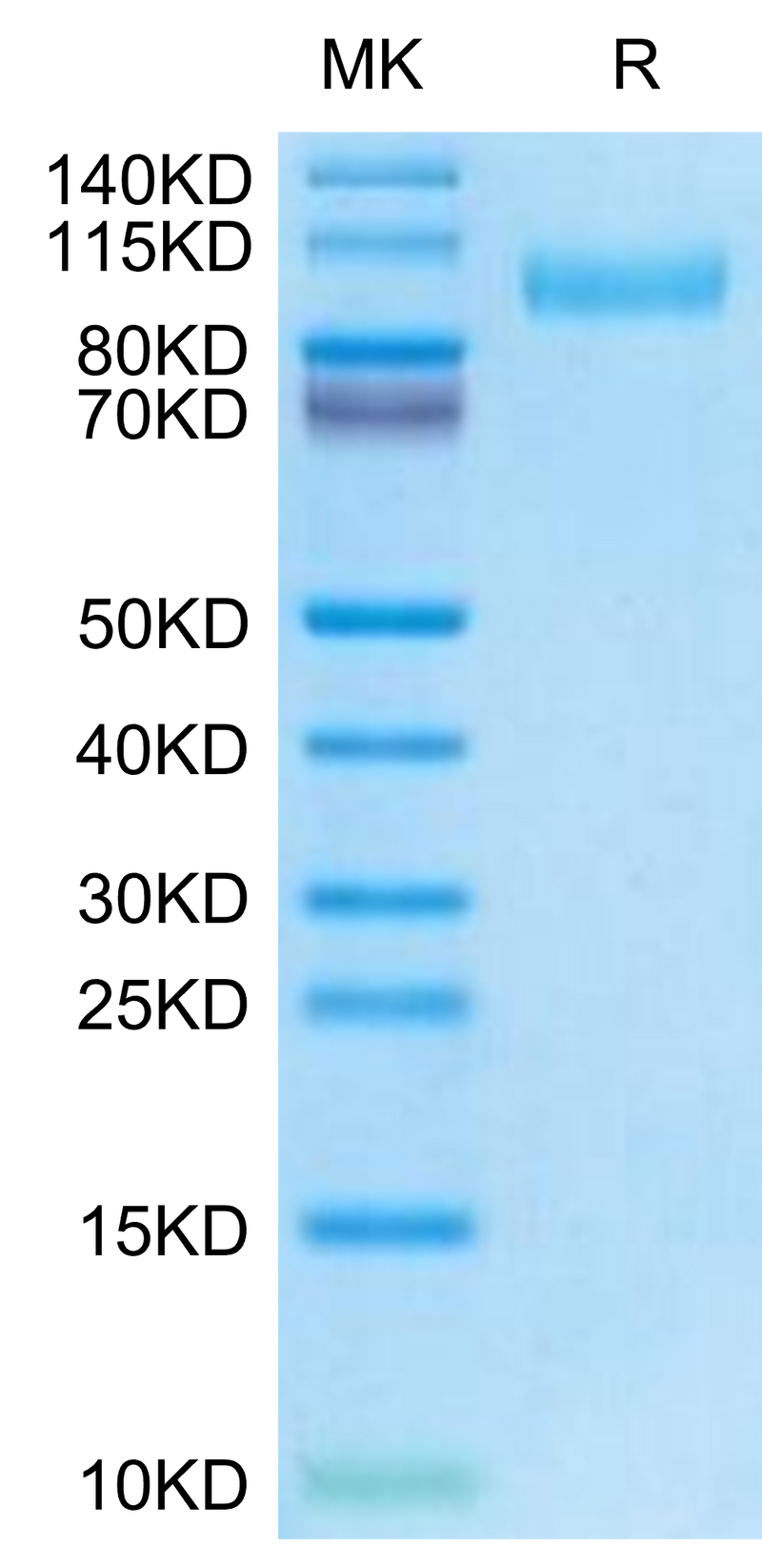 Mouse EGFR on Tris-Bis PAGE under reduced condition. The purity is greater than 95%.Recombinant Mouse EGFR/HER1 Protein, Active