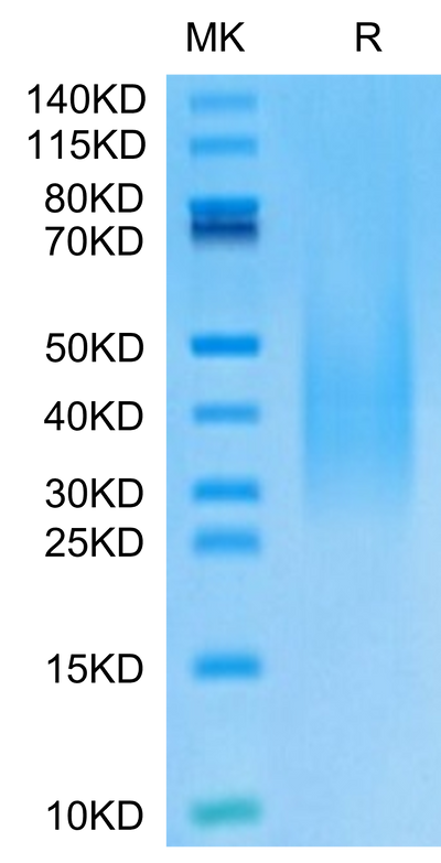 Monkeypox virus A30 on Tris-Bis PAGE under reduced condition. The purity is greater than 95%.Recombinant Monkeypox virus A30 Protein