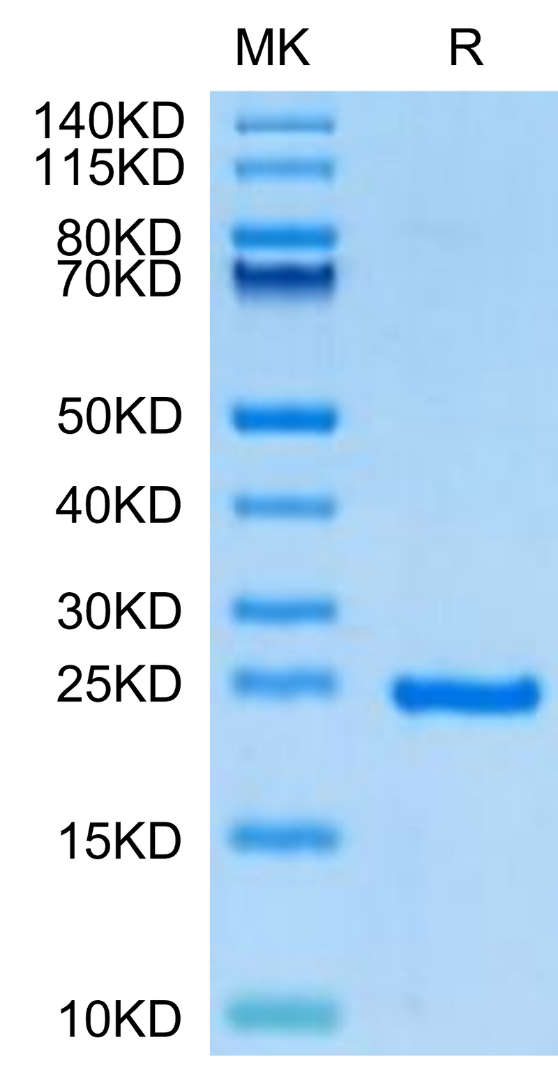 Human Sonic Hedgehog (Shh) on Tris-Bis PAGE under reduced condition. The purity is greater than 95%.Recombinant Human Sonic Hedgehog (Shh) Protein