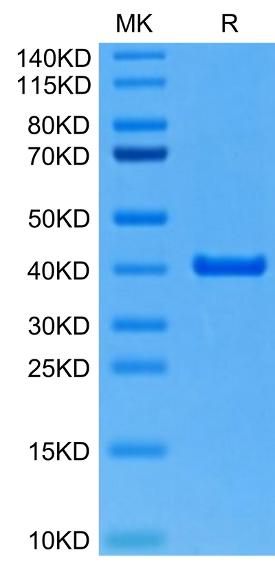 Mouse ANXA2 on Tris-Bis PAGE under reduced condition. The purity is greater than 95%.Recombinant Mouse ANXA2 Protein