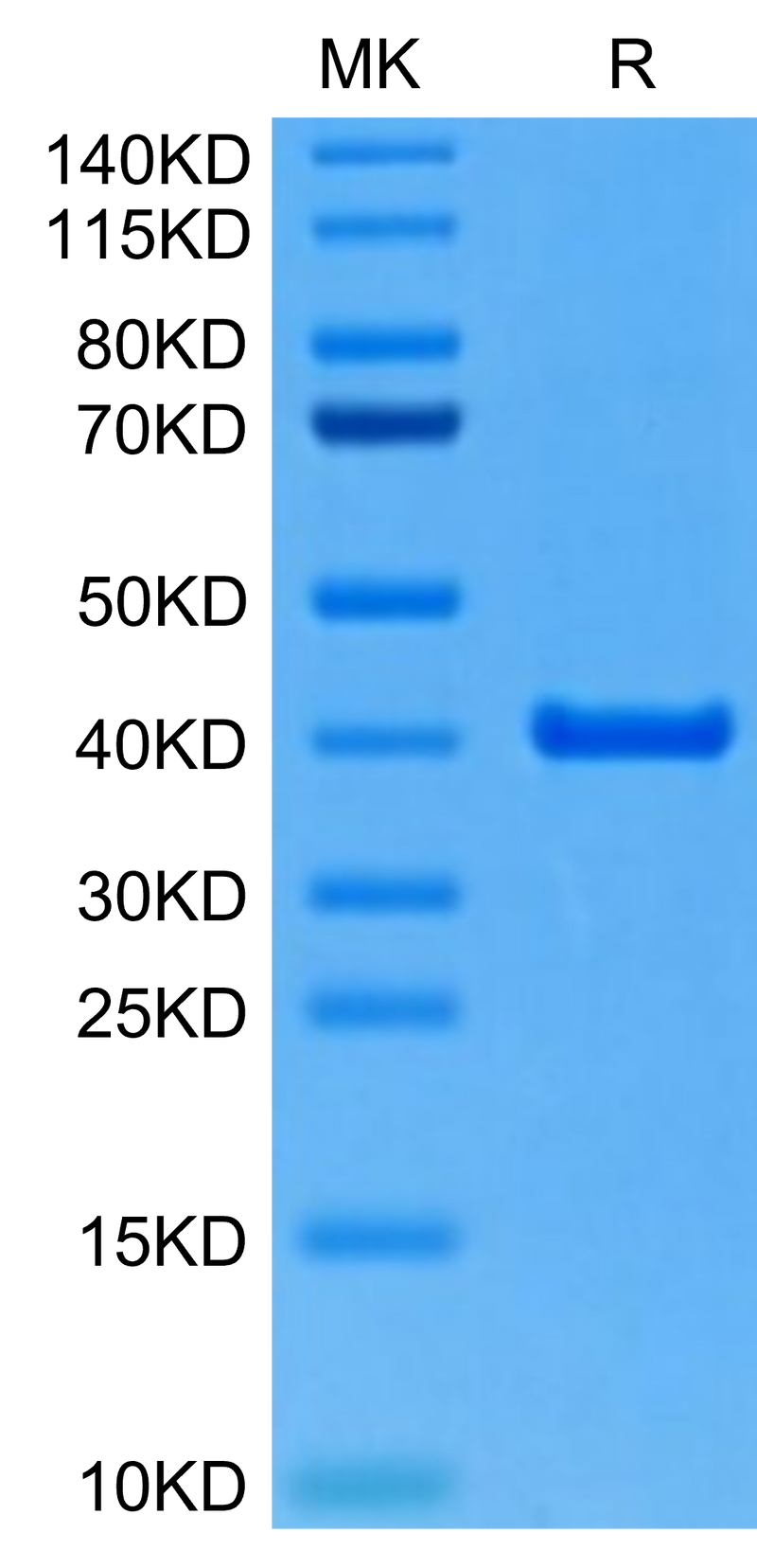 Mouse ANXA2 on Tris-Bis PAGE under reduced condition. The purity is greater than 95%.Recombinant Mouse ANXA2 Protein