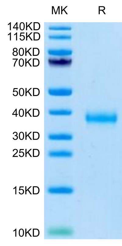 SARS-COV-2 Spike RBD (Delta B.1.617.2) on Tris-Bis PAGE under reduced condition. The purity is greater than 95%.Recombinant SARS-COV-2 Spike RBD (Delta B.1.617.2) Protein, Active