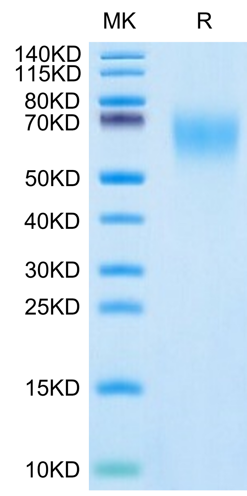 Cynomolgus CEACAM-6 on Tris-Bis PAGE under reduced condition. The purity is greater than 95%.Recombinant Cynomolgus CEACAM-6/CD66c Protein