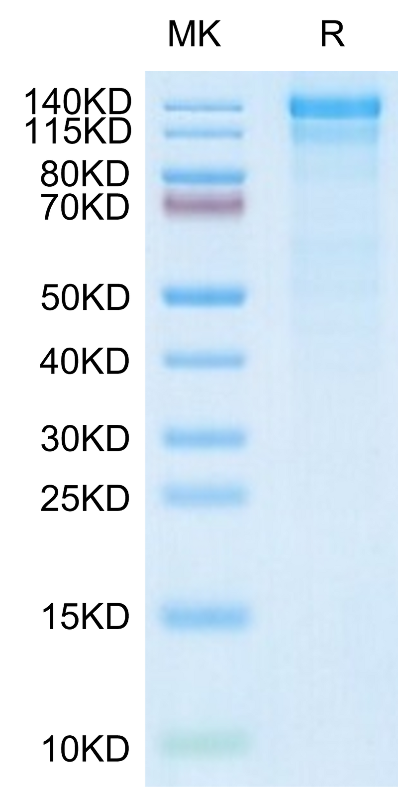 Human ITGA10&ITGB1 on Tris-Bis PAGE under reduced condition. The purity is greater than 90%.Recombinant Human Integrin alpha 10 beta 1 (ITGA10&ITGB1) Heterodimer Protein