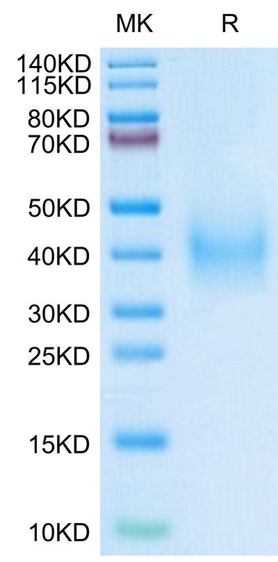 Human uPAR Domain (2+3) on Tris-Bis PAGE under reduced condition. The purity is greater than 95%.Recombinant Human uPAR/PLAUR Domain (2+3) Potein
