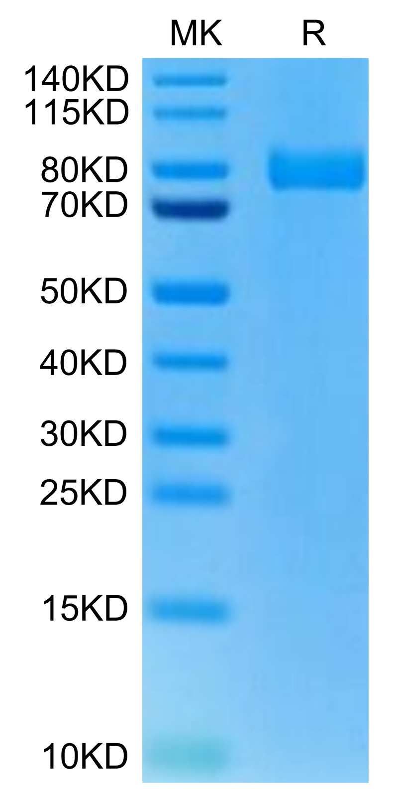 Rat XPNPEP2 on Tris-Bis PAGE under reduced condition. The purity is greater than 95%.Recombinant Rat XPNPEP2 Protein