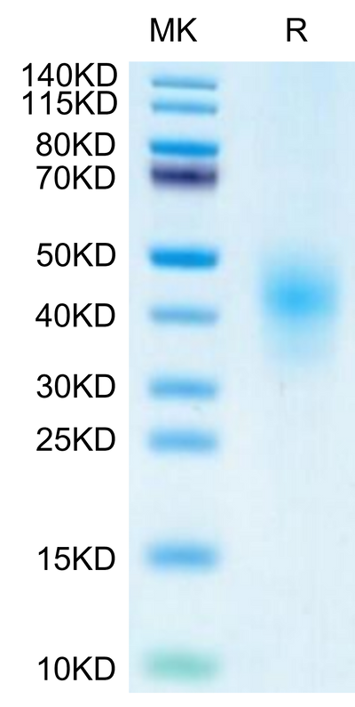 Cynomolgus NKG2D on Tris-Bis PAGE under reduced condition. The purity is greater than 95%.Recombinant Cynomolgus NKG2D/CD314 Protein, Active