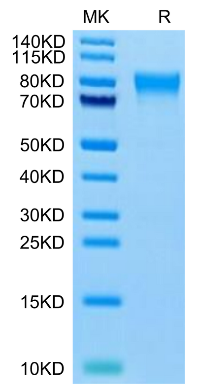 Human TEM7R on Tris-Bis PAGE under reduced condition. The purity is greater than 95%.Recombinant Human TEM7R/PLXDC2 Protein