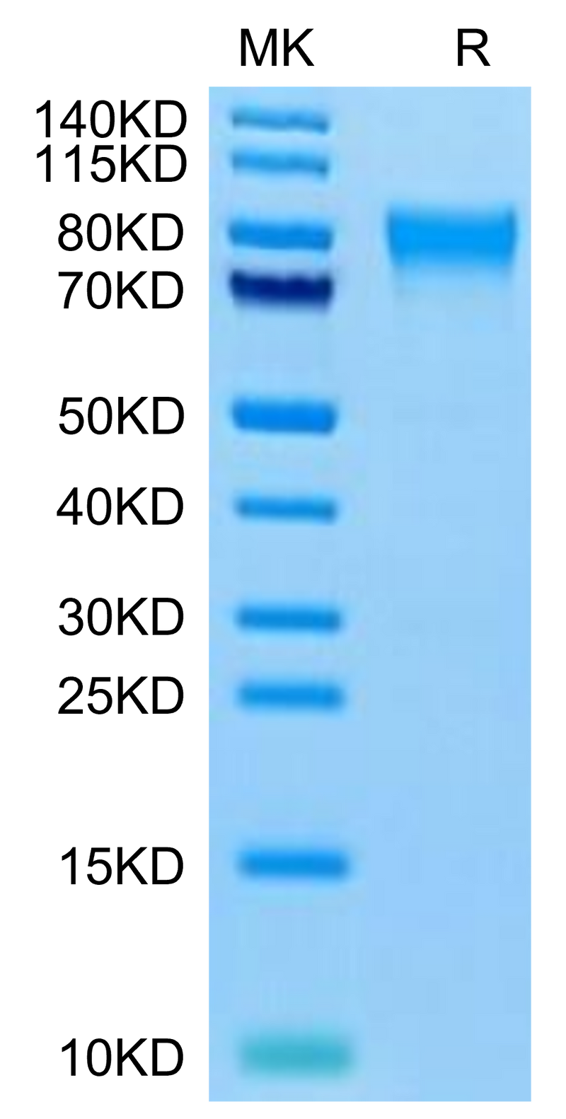 Human TEM7R on Tris-Bis PAGE under reduced condition. The purity is greater than 95%.Recombinant Human TEM7R/PLXDC2 Protein