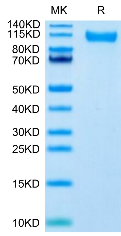 SARS-CoV-2 Spike S1 (Delta B.1.617.2) on Tris-Bis PAGE under reduced condition. The purity is greater than 95%.Recombinant SARS-CoV-2 Spike S1 (Delta B.1.617.2) Protein, Active
